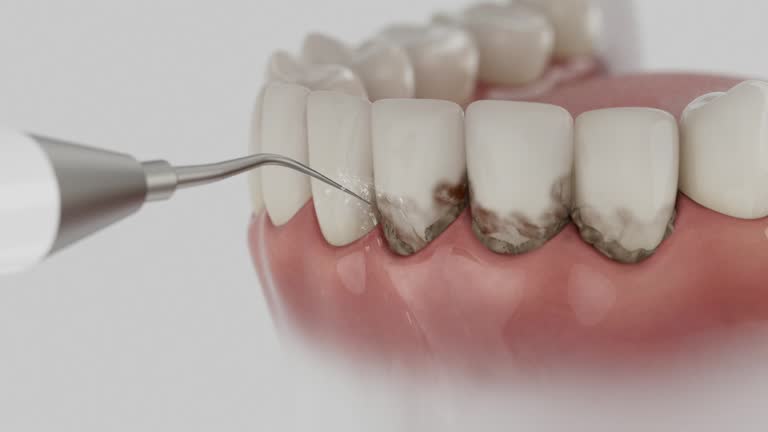 Reliable Dental contractor in Bonadelle Ranchos, CA by Dentist Open Now